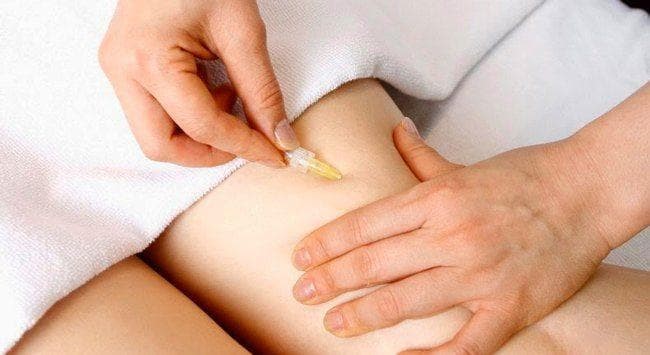 Carboxiterapia: inxecta vitalidade na túa pel de forma indolora