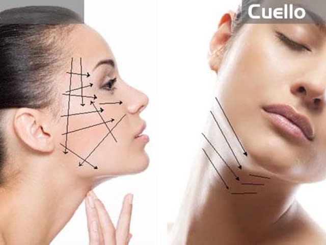 Estiramento facial non cirúrxico con fíos PDO