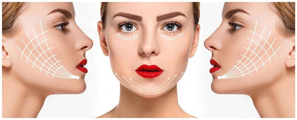 Fíos tensores: a solución ao flacidez facial