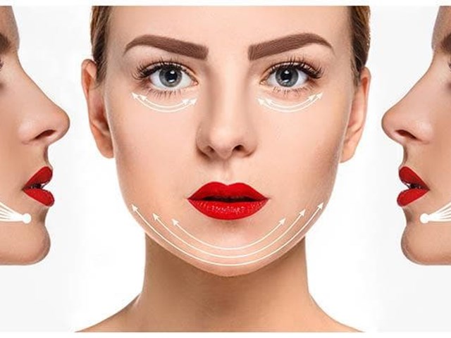 Fíos tensores: a solución ao flacidez facial