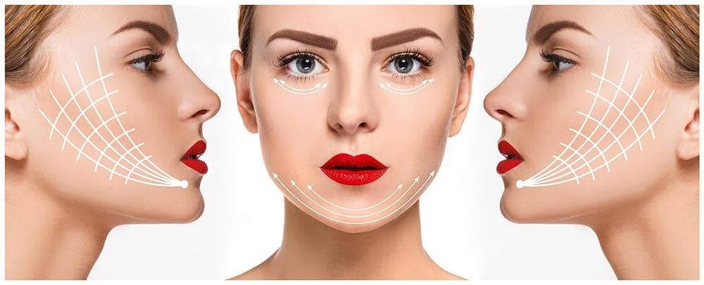 Hilos tensores: la solución frente a la flacidez facial