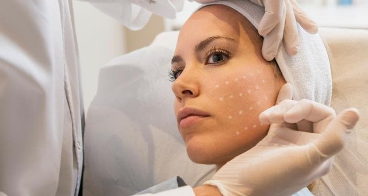 Mesoterapia facial para revitalizar el rostro