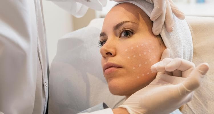 Mesoterapia facial para revitalizar o rostro